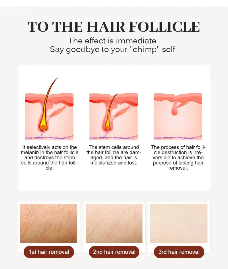 4000W Face 808nm Diode Laser Hair Removal Machine Alexandrit Permanent Painless Physical Underarm Body Care Depilation Equipment Smart_Life_Tech